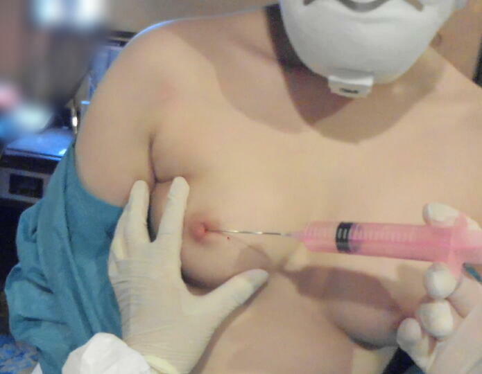 右乳房注射